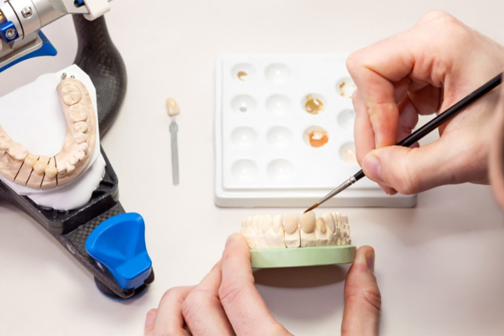 Giornata europea degli odontotecnici: ecco perché la bocca sicura è un tuo diritto